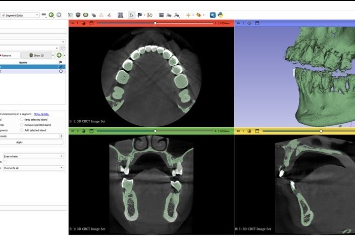 Tecnología CAD/CAM - Instituto Dental Mediterráneo